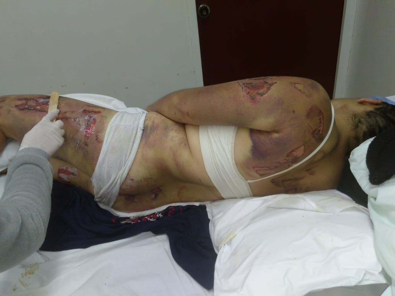 Con un machete marido celoso pretendía arrancarle la piel a su compañera sentimental 7