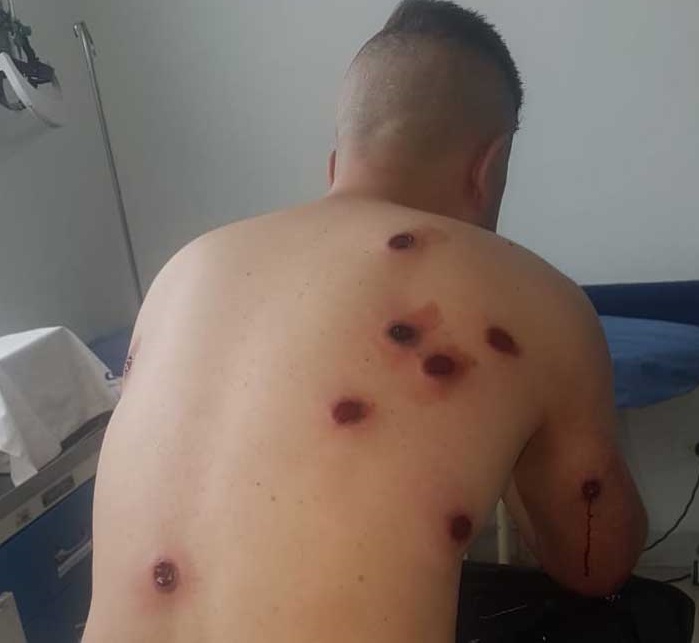 Policía atracador fue enviado a la cárcel de Picaleña 4