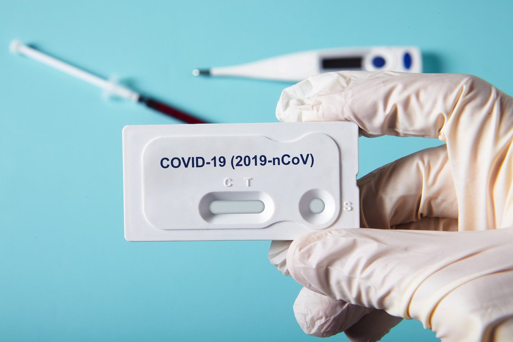 Las EPS deberán practicar pruebas rápidas para covid-19 1