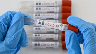Cinco ibaguereños las nuevas víctimas del Covid en el Tolima 3