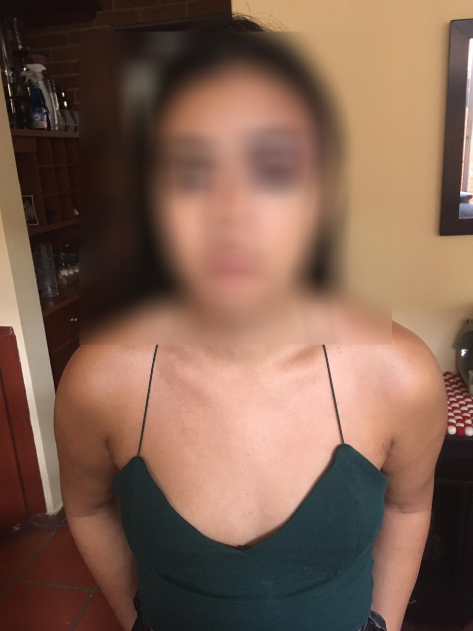 Violento DJ por poco asesina a golpes a su novia 8