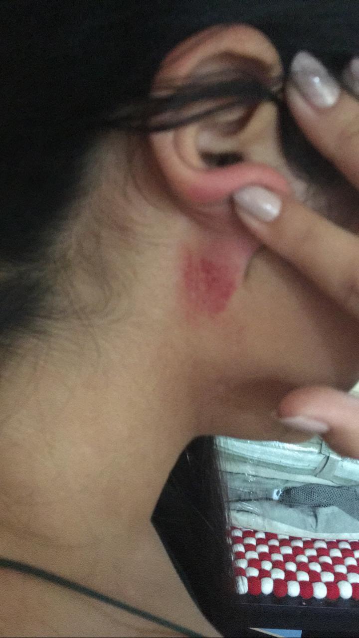 Violento DJ por poco asesina a golpes a su novia 10