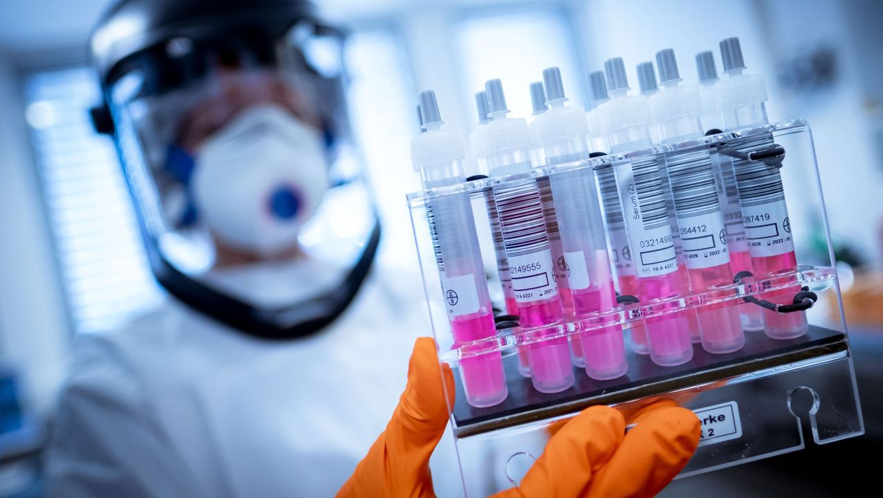 En Israel se desarrolló un anticuerpo para el coronavirus 3