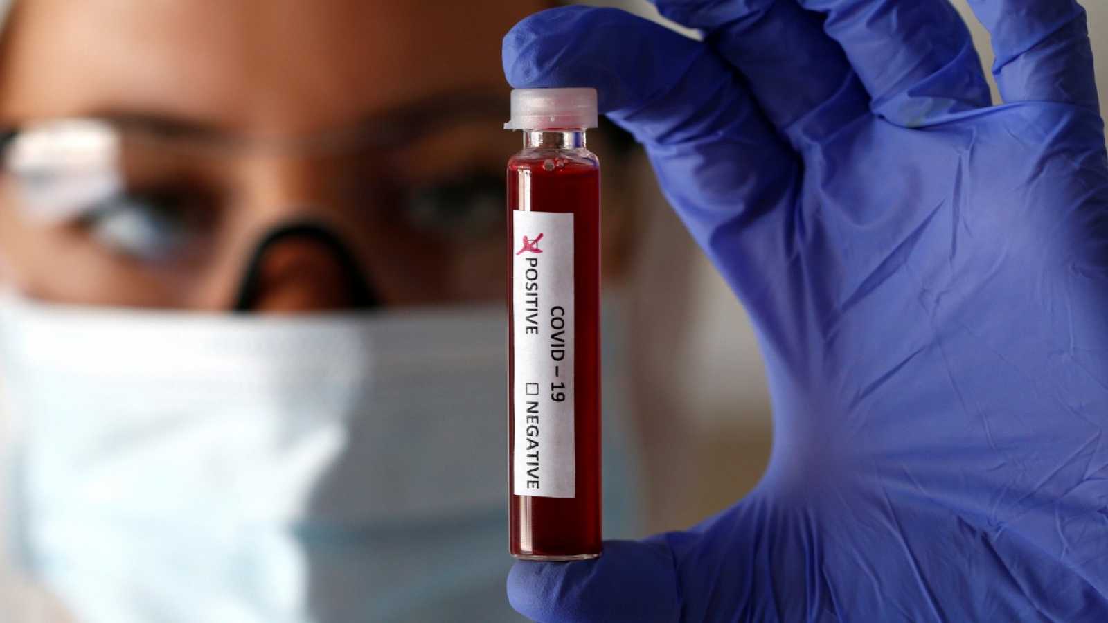 171 fallecidos y 4.101 nuevos contagios de covid-19 5