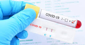 Todas las personas que tengan síntomas deben aislarse para evitar la propagación de casos de COVID-19 4