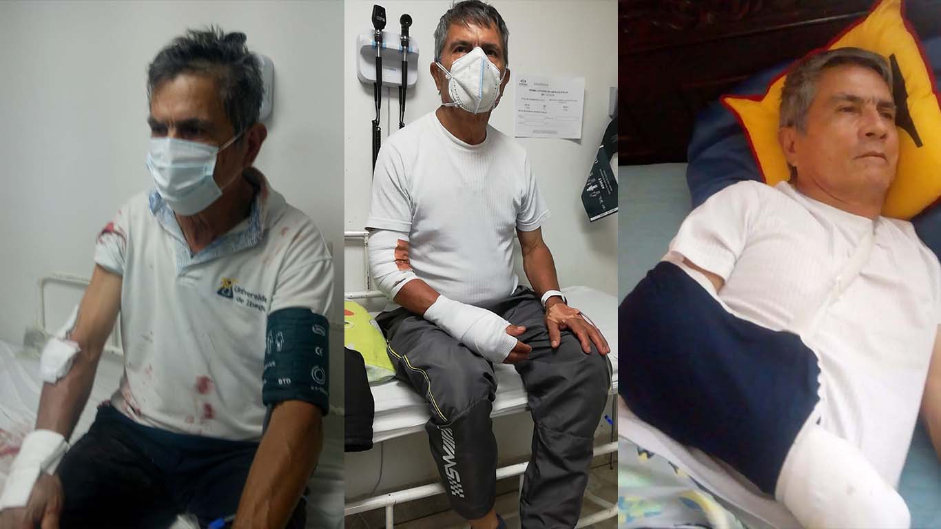 El relato de un abuelo que salvó a su nieto de ser atacado por pitbulls 1