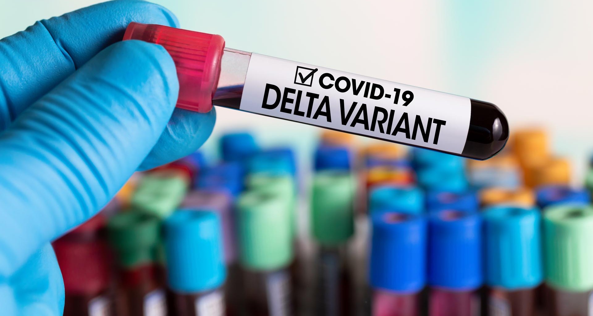 Confirman variante Delta en el país 1