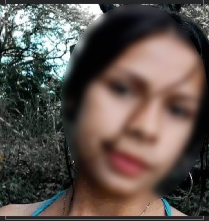 Adolescente resultó herida con arma de fuego en su cabeza 1