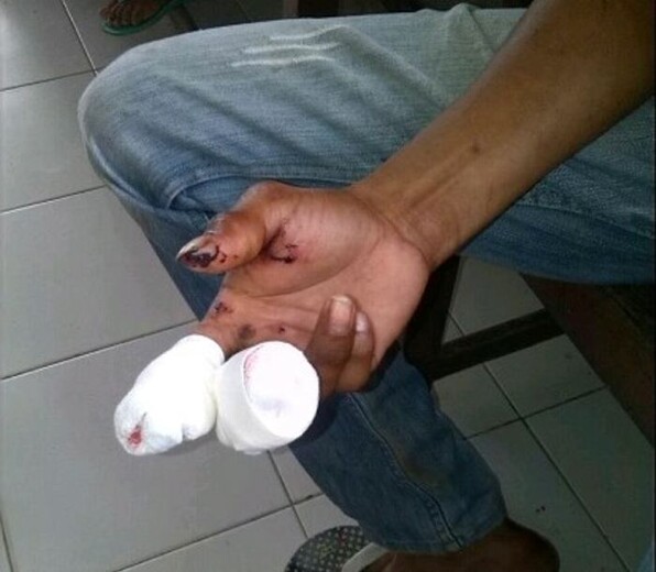Tolima registra 12 personas lesionadas con pólvora 3
