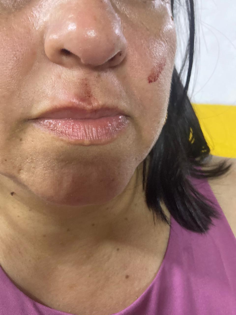 Tripulantes de ambulancia agredieron a usuarios por reclamar buen servicio 2