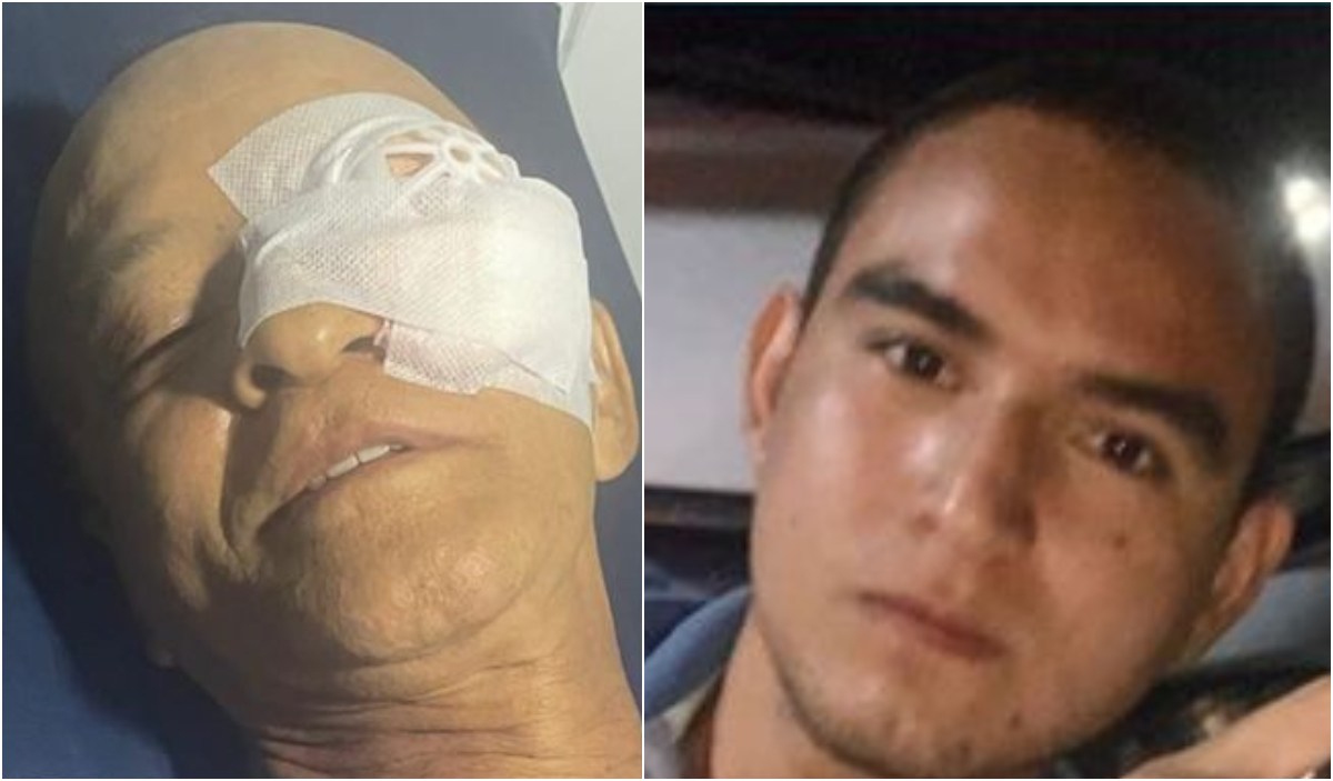 Hombre con problemas psiquiátricos atacó a un vecino y le sacó un ojo 1