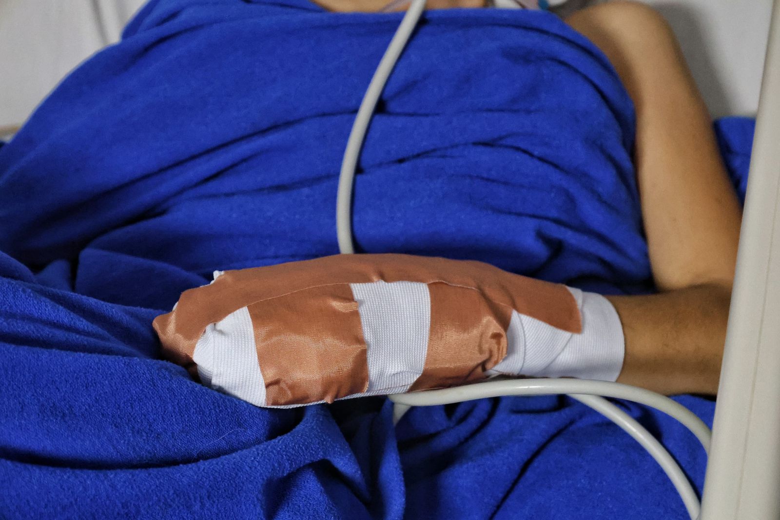 Balance antes de Noche de Velitas: 33 niños, niñas y adolescentes lesionados con pólvora 1