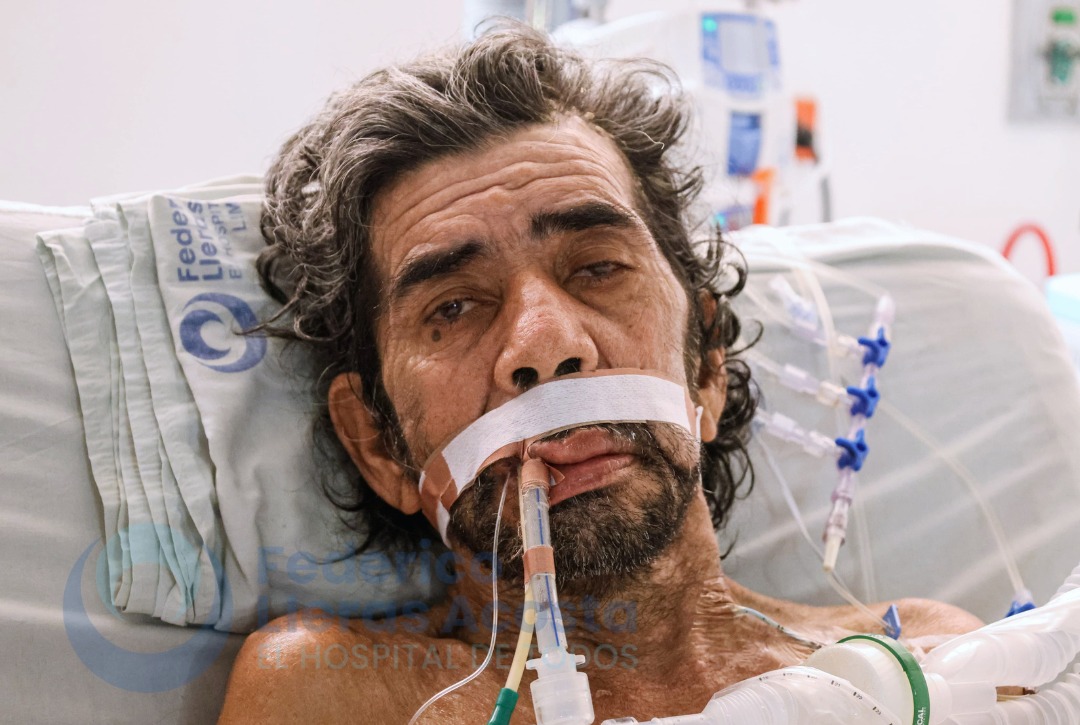 Hospital Federico Lleras Acosta solicita ayuda para localizar familiares de paciente Gerson Ortiz 1