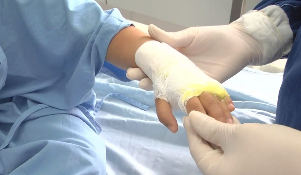 La temporada de Navidad y fin de año deja 47 personas lesionadas por la pólvora en el Tolima 1