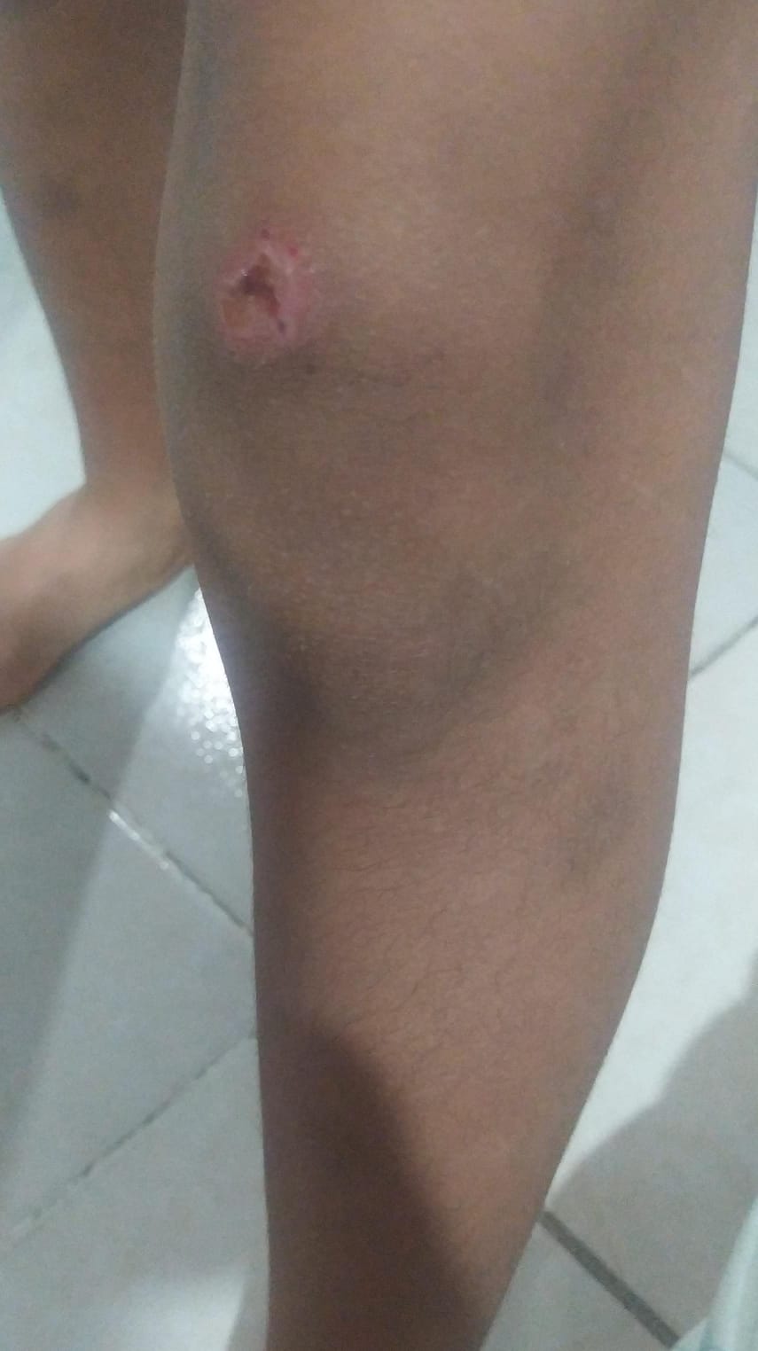 Estudiantes agredieron niño de 8 años en la Escuela Normal Superior 4