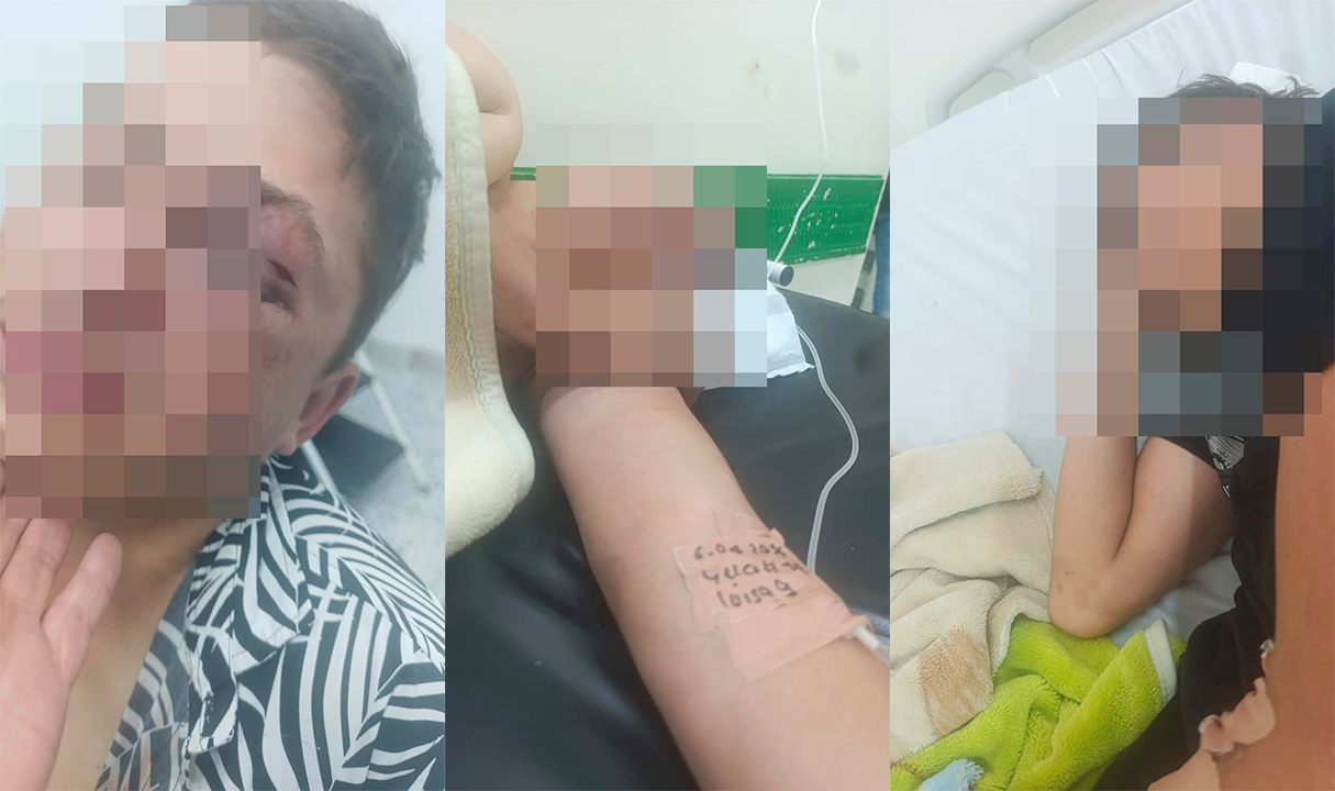 “No hay ley en Cajamarca”: madre denuncia agresión a su hijo de 15 años en bar 1