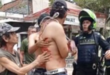 Violenta riña en La Gaviota deja un lesionado con arma blanca 17